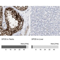 Exportin-5 Antibody, Novus Biologicals:Antibodies:Primary Antibodies